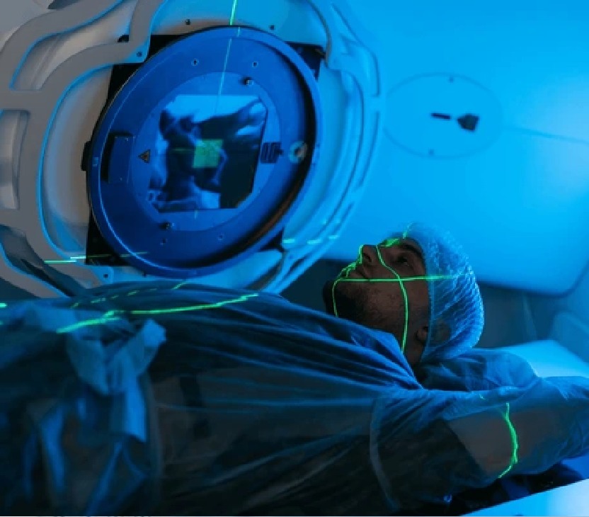 Stereotactic Body Radiation Therapy (SBRT)